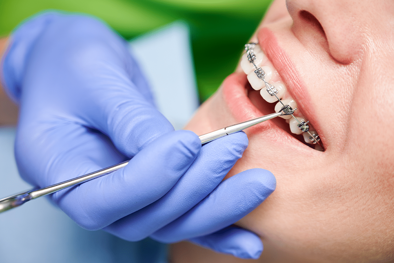 orthodontic-treatment